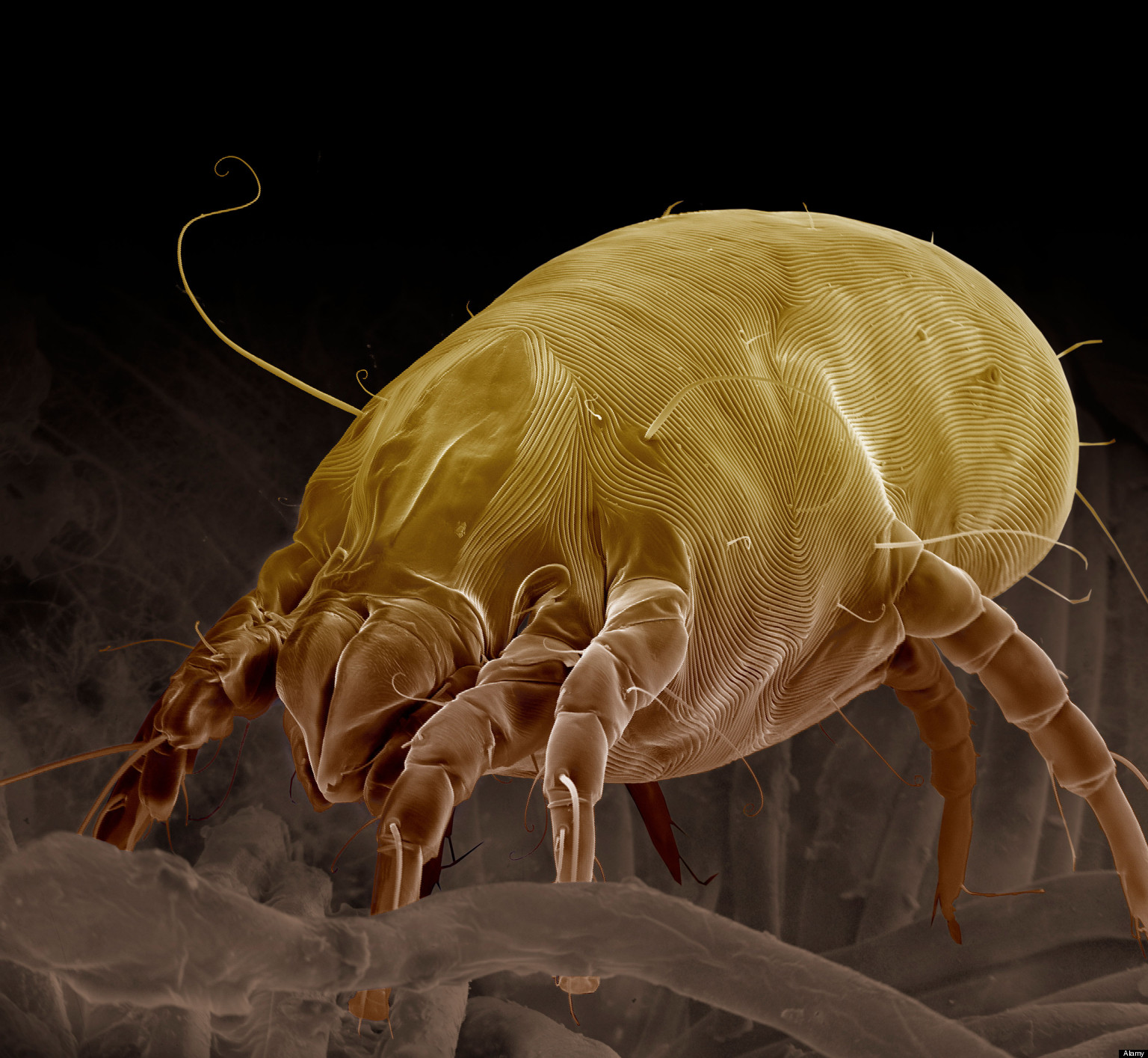 Scanning Electron Micrograph Sem Of A Dust Mite Dermatophagoides